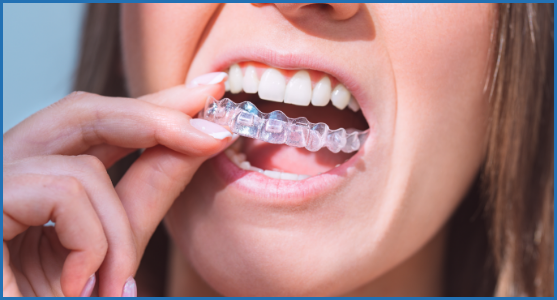 AdobeStock_410514850 Blogs